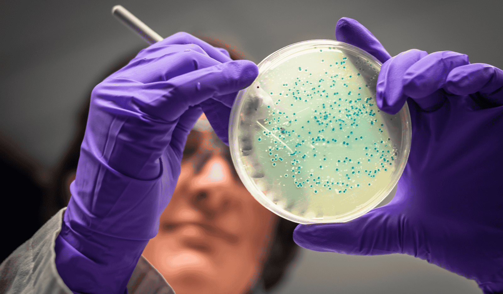 Microbial Disinfection Treatment For Coronavirus